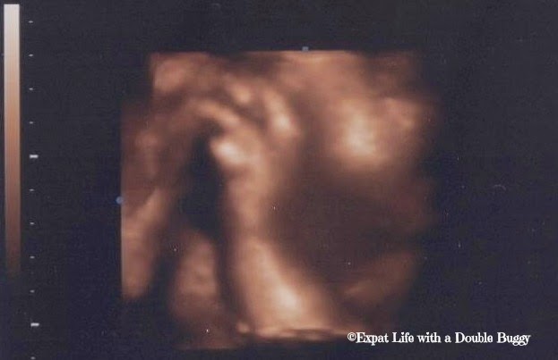457e4-scan Kirstie Allsopp and When to Have a Baby: Mission Completed