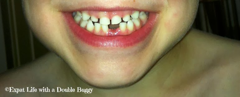 45b18-toothless Boy Tooth Fairies Don't Mind Messy Bedrooms